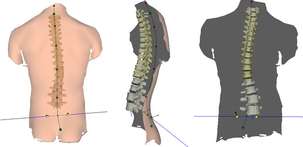 FAQs - Part 1 - Scoliosis and Spine Associates